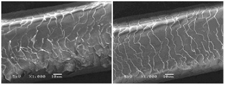 キューティクル